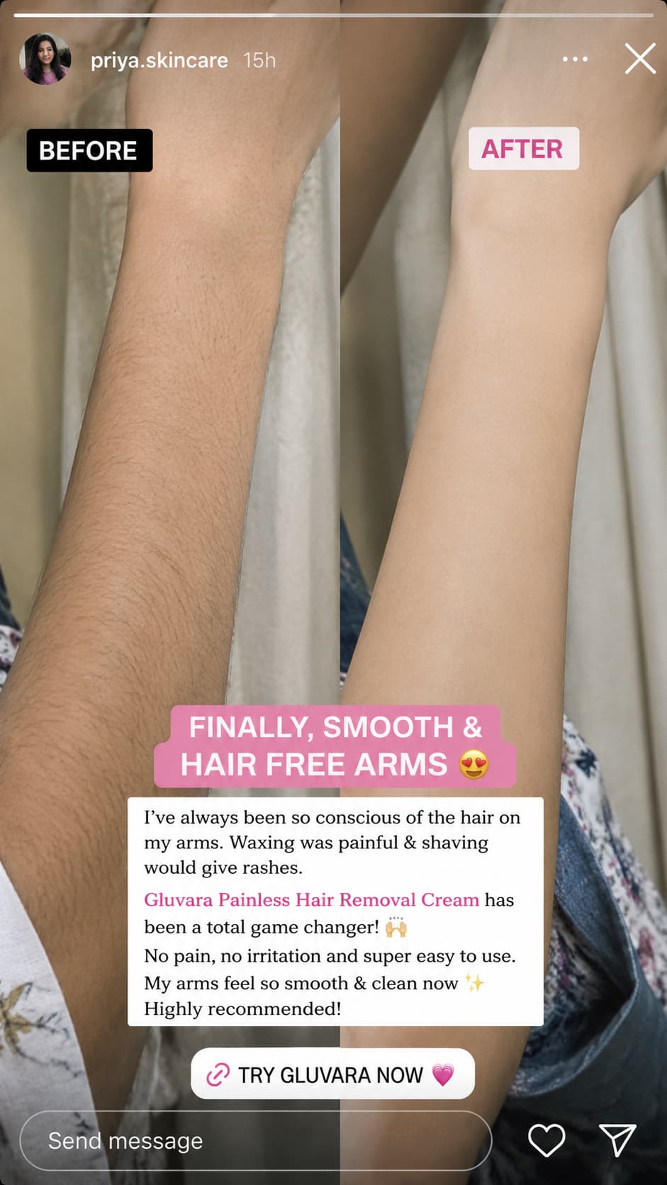 Gluvara Painless Hair Removal Cream